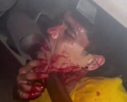 Motorcyclist impaled through neck on car’s exhaust pipe