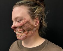 Pitbull mauls woman after she suffers seizure