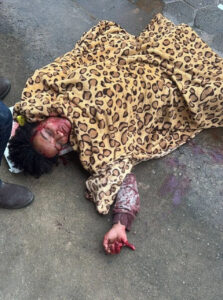 Severely injured woman after being attacked by drug dealer