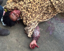 Severely injured woman after being attacked by drug dealer