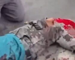 Street vendor suffers partial traumatic leg amputation