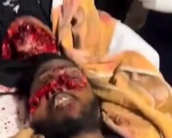 Two young motorcyclists suffered devastating injuries