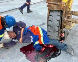 Worker’s thigh crushed by heavy machinery