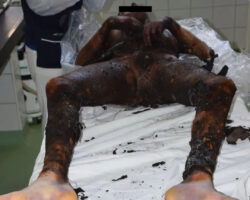 Young man electrocuted while taking selfie on train