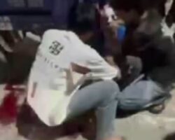 Young man lost his arm in accident on modified motorcycle