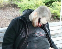 Young man shot himself in head on park bench