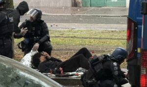 17-year-old protester loses hand in grenade blast