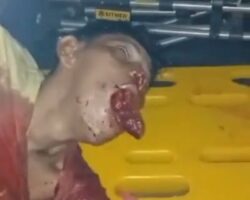 Bloodied man found with part of his tongue cut off