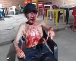 Brutal assault on bar patron
