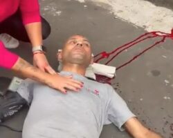 Bystander shot in head while trying to stop robbery suspects