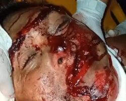 Cyclist riding modified bike hit by oncoming truck
