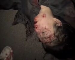 Dying woman after being attacked by her jealous partner