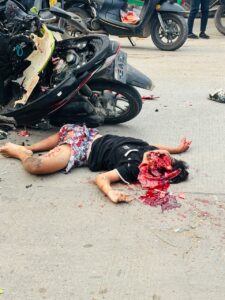 Head crushed by truck