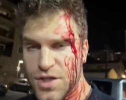Keegan Allen pistol-whipped and robbed in West Hollywood