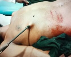 MIX: Victims of Papuan tribal wars #3