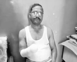 Man loses hand in firework explosion