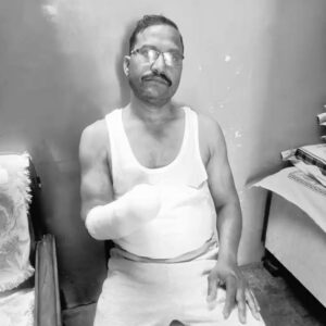 Man loses hand in firework explosion