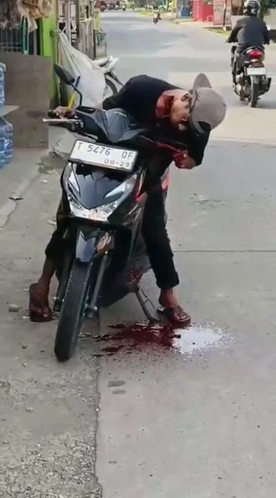 Motorcyclist bleeds profusely after kite wire slashes his throat ...