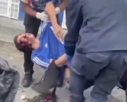 Motorcyclist loses control and slams into wall