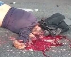 Motorcyclist’s head crushed by truck after collision with car