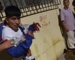 Teen extortionist injured by his own explosive device