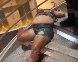Woman after falling from 15th floor