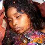 Raped and almost beheaded young girl