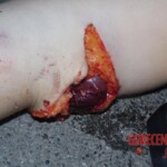 Teenage girl cut in half after jumping off a building