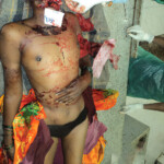 Traffic accident took her head off