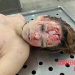 Naked dead girl in morgue