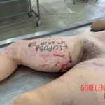 Naked dead girl in morgue
