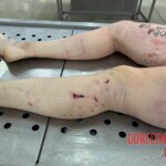 Female corpse in morgue