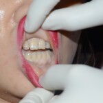 Suicide by poisoning