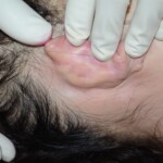 Suicide by poisoning