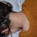 Suicide by poisoning