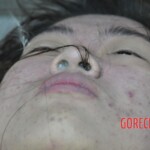 Drowned Chinese girl