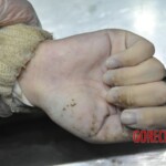 Drowned Chinese girl