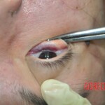 Drowned Chinese girl