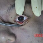 Drowned Chinese girl