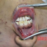 Drowned Chinese girl