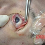 Drowned Chinese girl