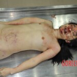 Chinese girl in morgue naked