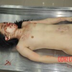 Chinese girl in morgue naked