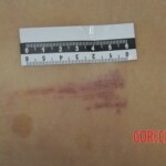 Chinese girl in morgue