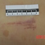 Chinese girl in morgue