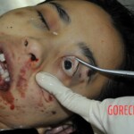 Chinese girl in morgue