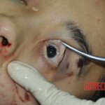 Chinese girl in morgue