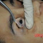 Chinese girl in morgue