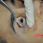 Chinese girl in morgue