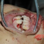 Chinese girl in morgue